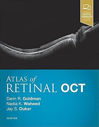 Atlas of Retinal OCT: Optical Coherence Tomography 1st 2018